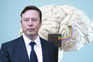 Elon Musk ,İkinci Beyin Çipi İmplantı İçin FDA Onayını Aldı