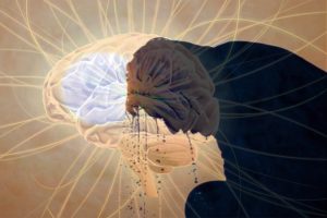 Kavurucu Sıcaklar İnme Riskini Arttırıyor