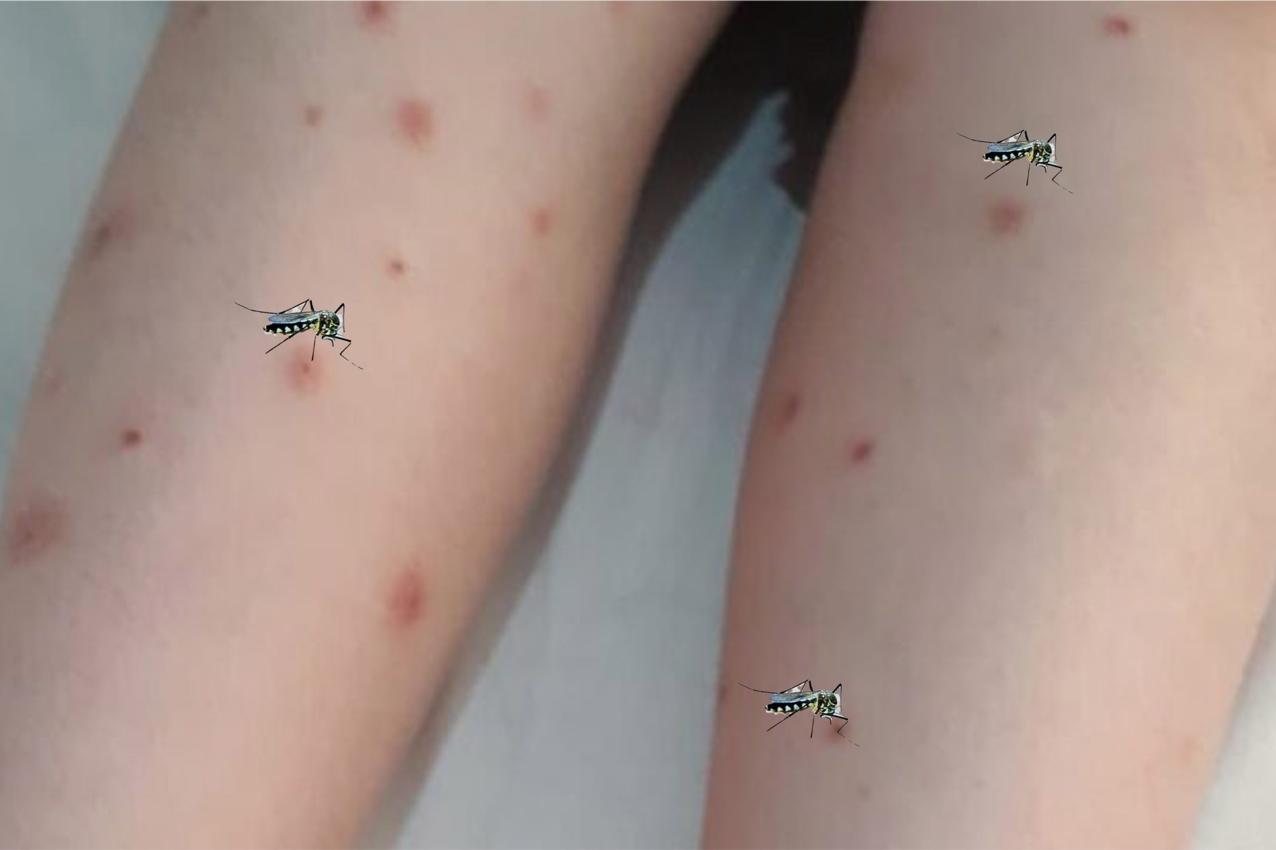 Avrupa Hastalık Önleme ve