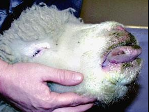 Mavi Dil Hastalığı Nedir?