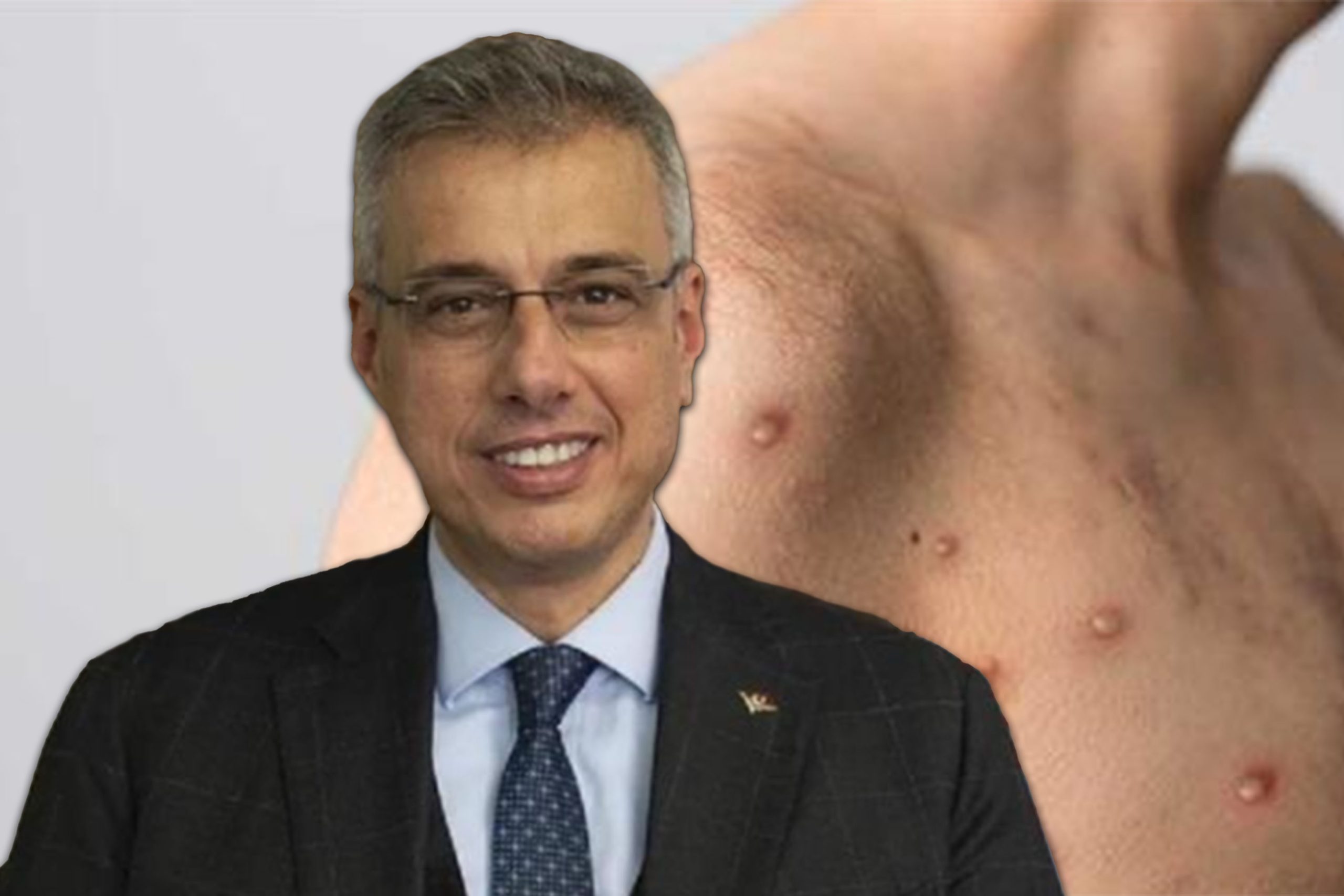 Sağlık Bakanı Kemal Memişoğlu, Türkiye’de